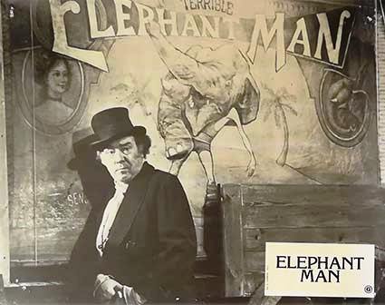 Elephant man